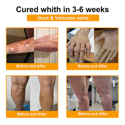 Bee Venom Joint Relief Patch 👑👑 (Specially for Older Adults)