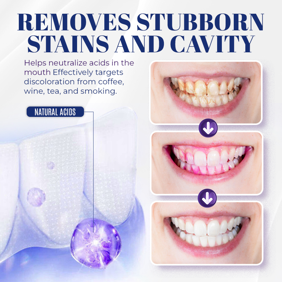 🦷Bright Smile, Within Reach: Seurico™ Coconut Oil Whitening Strips