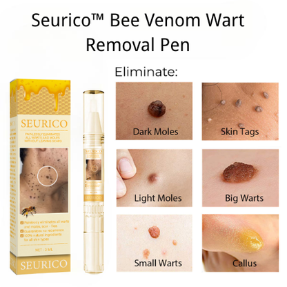 🐝Last Day Promotion 49% OFF Seurico™ Bee Venom Wart Removal Pen