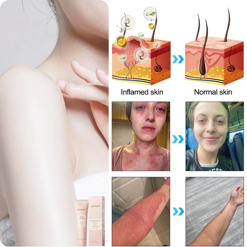 ✨𝐋𝐚𝐬𝐭 𝐃𝐚𝐲 𝐃𝐢𝐬𝐜𝐨𝐮𝐧𝐭: 90% 𝐎𝐅𝐅🔥 Seurico™ Exfoliating Gel