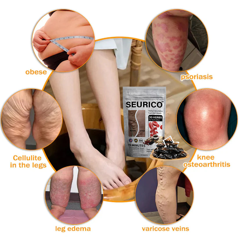 🌿Seurico™ Herbal VenoDetox Foot Bath Beads🌲(𝐋𝐀𝐍𝐀 𝐂𝐞𝐫𝐭𝐢𝐟𝐢𝐜𝐚𝐭𝐢𝐨𝐧，𝗟𝘆𝗺𝗽𝗵𝗮𝘁𝗶𝗰 𝗔𝘀𝘀𝗼𝗰𝗶𝗮𝘁𝗶𝗼𝗻 𝗼𝗳 𝗔𝗺𝗲𝗿𝗶𝗰𝗮)