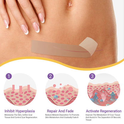 ✅Official Store |NEGUSY® Hyaluronic Acid Nano Microneedle Repair Tape🏥(Treatment of old and new scars, reduction of surgical scars, stretch marks, keloids, acne, burns, warts, dermatomes and varicose veins)