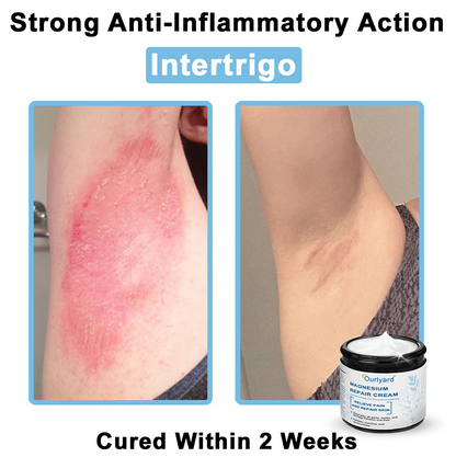 🏆✅Mayo Clinic Official: Magnesium skin repair cream (Eczema and Psoriasis Relief, Skin Repair, Even Tone, Acne and Dark Spot Treatment, Wart and Mole Removal)