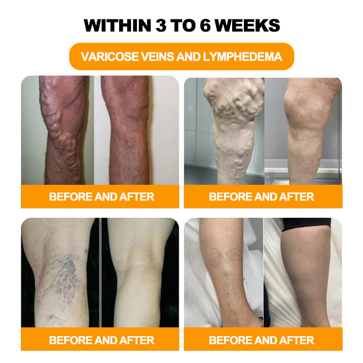 🌿Seurico™ Herbal VenoDetox Foot Bath Beads🌲(𝐋𝐀𝐍𝐀 𝐂𝐞𝐫𝐭𝐢𝐟𝐢𝐜𝐚𝐭𝐢𝐨𝐧，𝗟𝘆𝗺𝗽𝗵𝗮𝘁𝗶𝗰 𝗔𝘀𝘀𝗼𝗰𝗶𝗮𝘁𝗶𝗼𝗻 𝗼𝗳 𝗔𝗺𝗲𝗿𝗶𝗰𝗮)