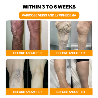 🌿Seurico™ Herbal VenoDetox Foot Bath Beads🌲(𝐋𝐀𝐍𝐀 𝐂𝐞𝐫𝐭𝐢𝐟𝐢𝐜𝐚𝐭𝐢𝐨𝐧，𝗟𝘆𝗺𝗽𝗵𝗮𝘁𝗶𝗰 𝗔𝘀𝘀𝗼𝗰𝗶𝗮𝘁𝗶𝗼𝗻 𝗼𝗳 𝗔𝗺𝗲𝗿𝗶𝗰𝗮)