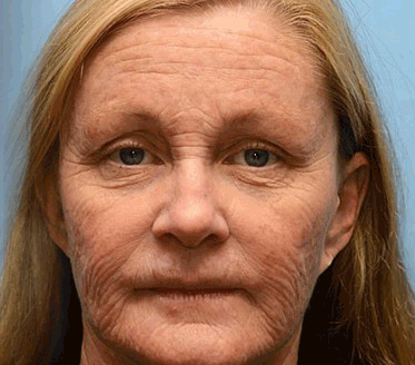 🐄Seurico™ Grass Fed Tallow Balm