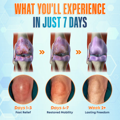 💪 Seurico™ Premium Curcumin Pain Relief Gel - Fast & Natural Relief for Joint & Muscle Pain! 🌿🔥