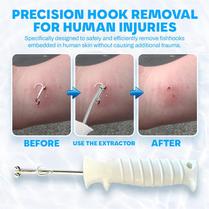 AquaGuard™ Quick Release Fish Hook Extractor