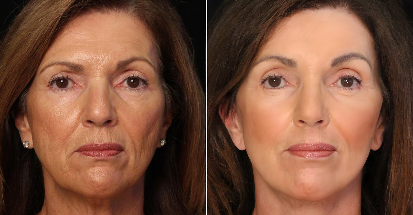 🤍Seurico™ Luxury Collagen Firming Cream-Deep Wrinkles and Revives a Youthful