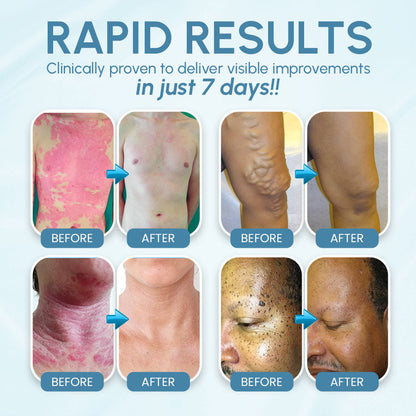 Zakdavi™ 7-Day Multi-Active All-in-One Skin Cream