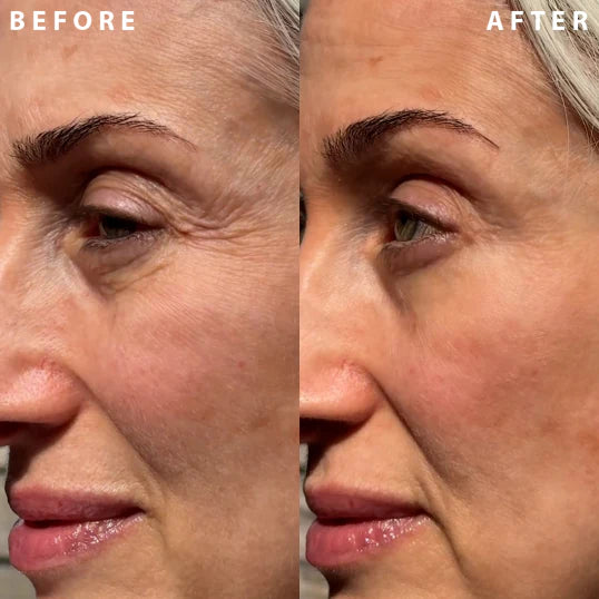 🤍Seurico™ Luxury Collagen Firming Cream-Deep Wrinkles and Revives a Youthful