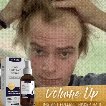 🌿 Odeiun™ Natural Hair Regrowth Spray – 70% OFF Ends Tonight! 🔥