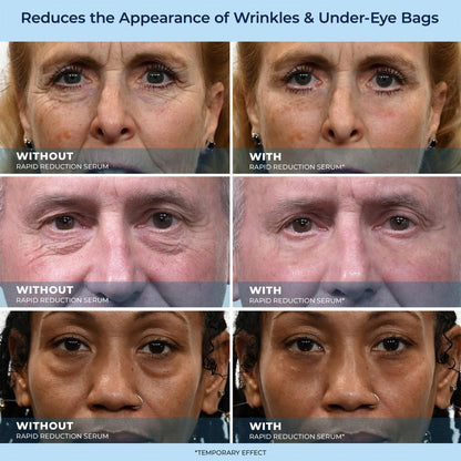 🔵LBMLBM™ 60-Second Anti-Aging Serum for Wrinkles, Bags & Dark Circles