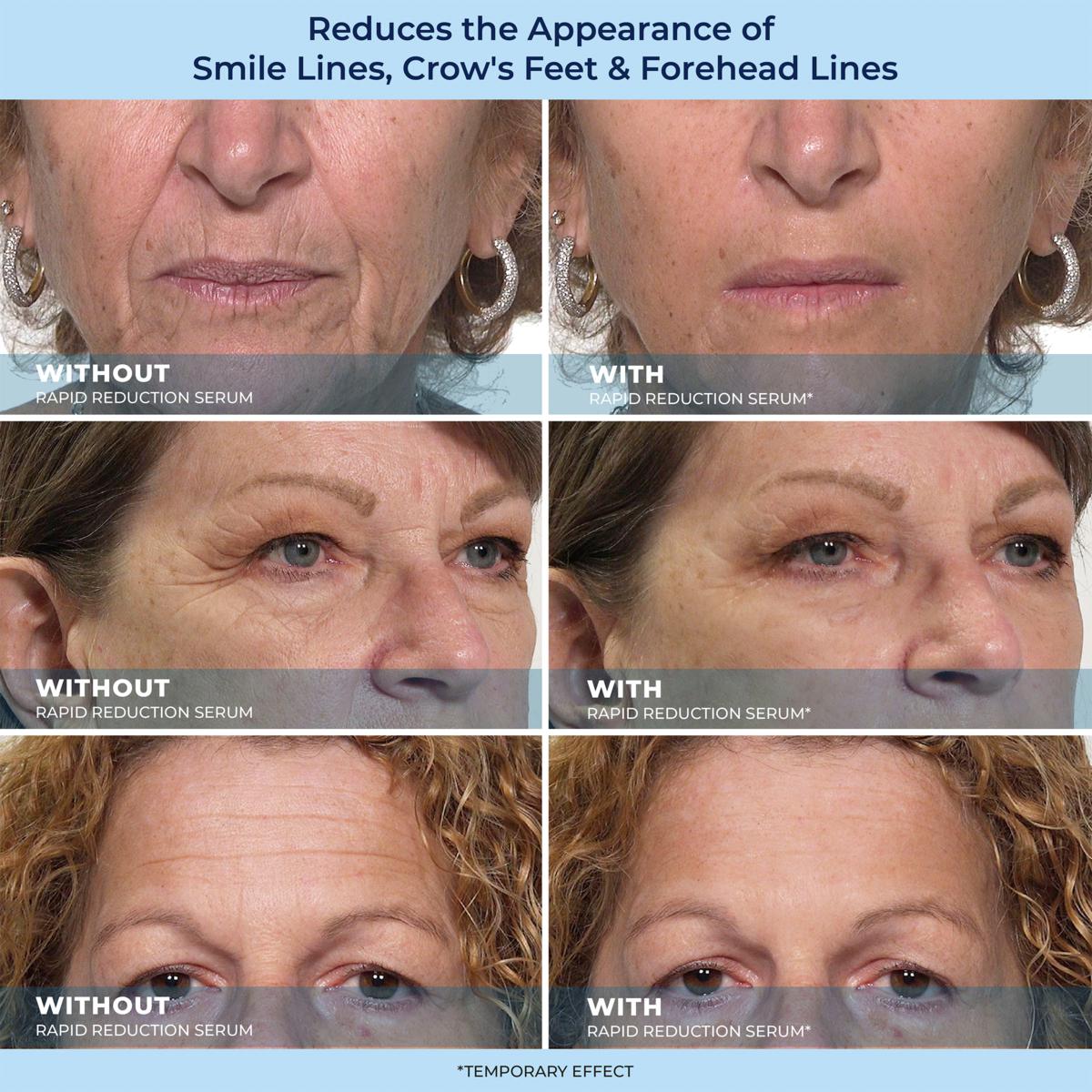 🔵LBMLBM™ 60-Second Anti-Aging Serum for Wrinkles, Bags & Dark Circles